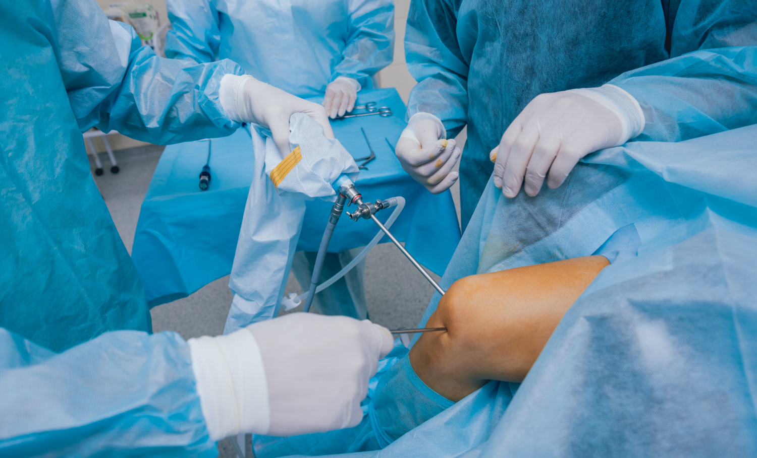 Arthroscopic Surgeries